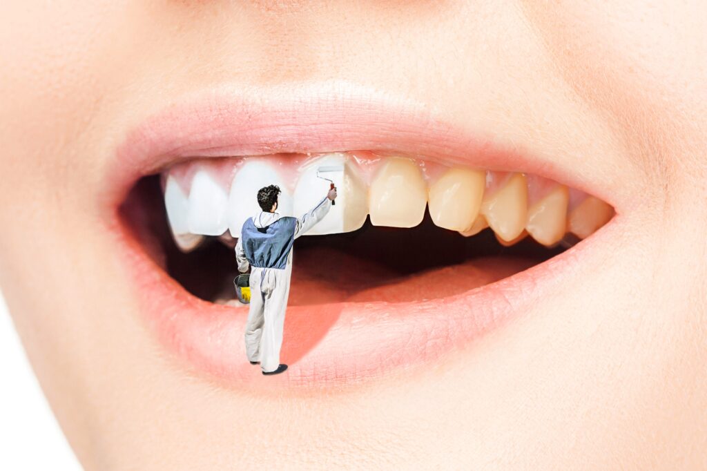 vergilbte Zähne werden wieder weiß - helle, glatte und glänzende Zähne durch regelmäßige Prophylaxe